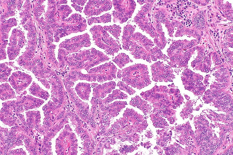 Researcher examining lung samples under a microscope