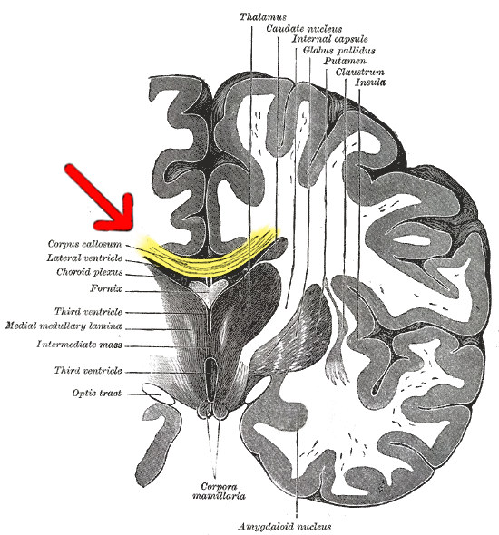 Highlighting the corpus callosum in brain anatomy.